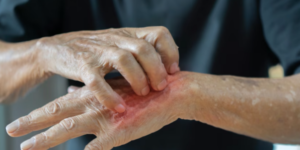 suga-se-siri-srbijom-gradjani-u-panici-nisu-krivi-strani-radnici-nego-nehigijena-screenshot-2026-03-10-144547_69b02232bbb69